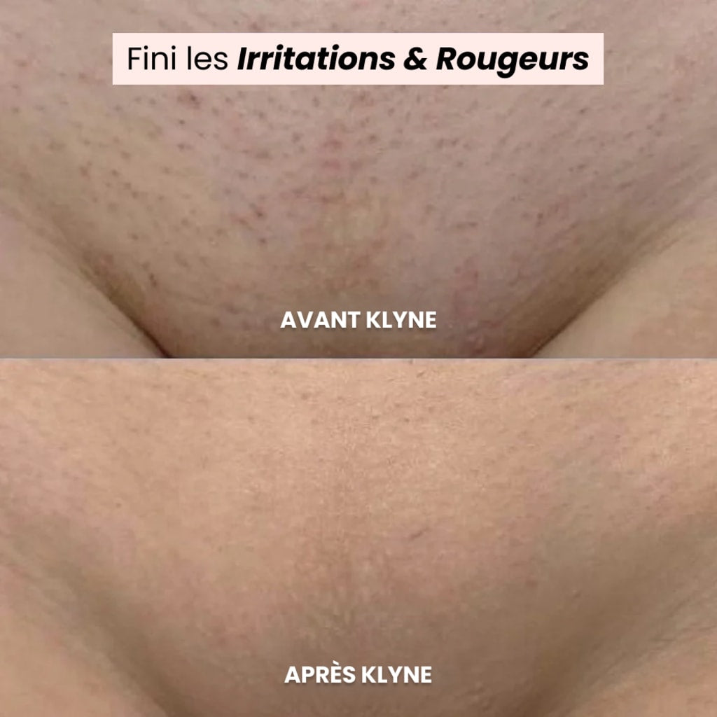 Rasoir LUNYA- L’innovation du rasage pour une peau douce et saine